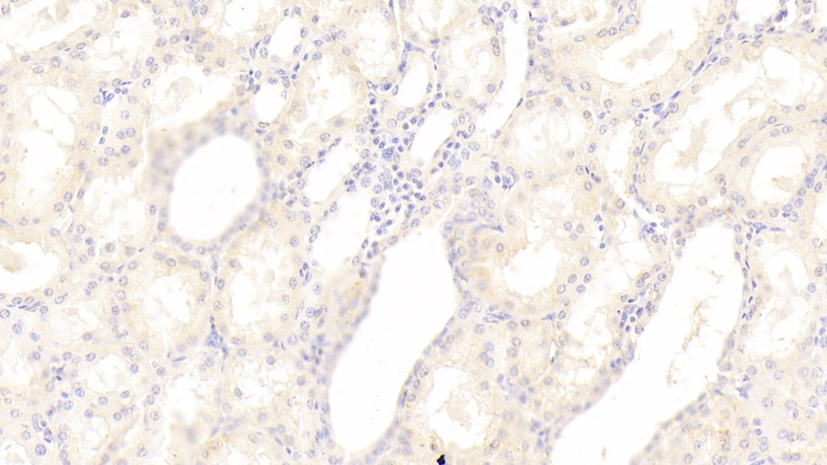 Polyclonal Antibody to Sphingosine 1 Phosphate Lyase 1 (SGPL1)