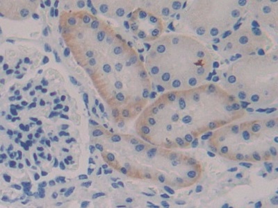 Polyclonal Antibody to Inhibitory Subunit Of NF Kappa B Epsilon (IkBe)