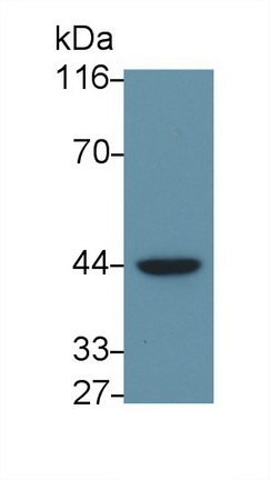 Polyclonal Antibody to Inhibitory Subunit Of NF Kappa B Delta (IkBd)