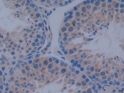 Polyclonal Antibody to Inhibitory Subunit Of NF Kappa B Delta (IkBd)