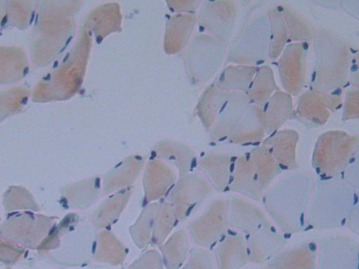 Polyclonal Antibody to Inhibitory Subunit Of NF Kappa B Delta (IkBd)