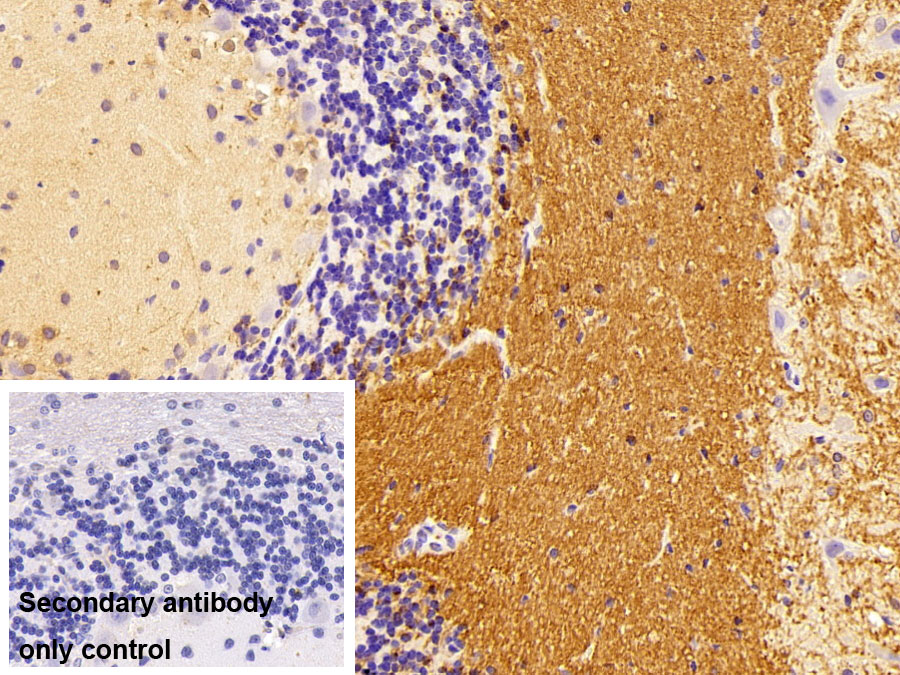 Polyclonal Antibody to Tubulin Beta 1 (TUBb1)