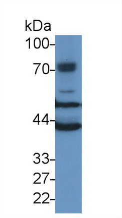 Polyclonal Antibody to Tubulin Beta 6 (TUBb6)