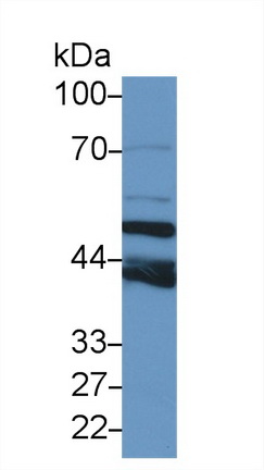 Polyclonal Antibody to Tubulin Beta 6 (TUBb6)