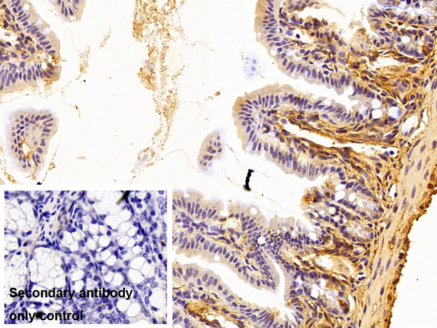 Polyclonal Antibody to Tubulin Alpha 4A (TUBa4A)