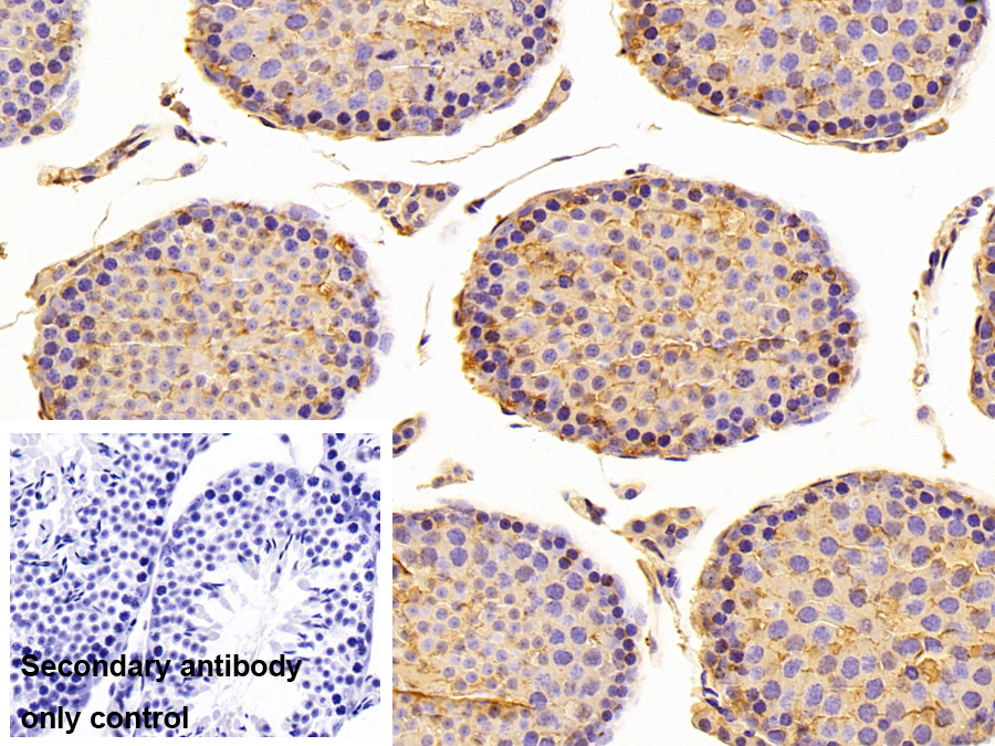 Polyclonal Antibody to Tubulin Alpha 4A (TUBa4A)