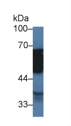 Polyclonal Antibody to Tubulin Delta (TUBd)