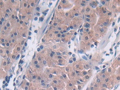 Polyclonal Antibody to Tubulin Delta (TUBd)