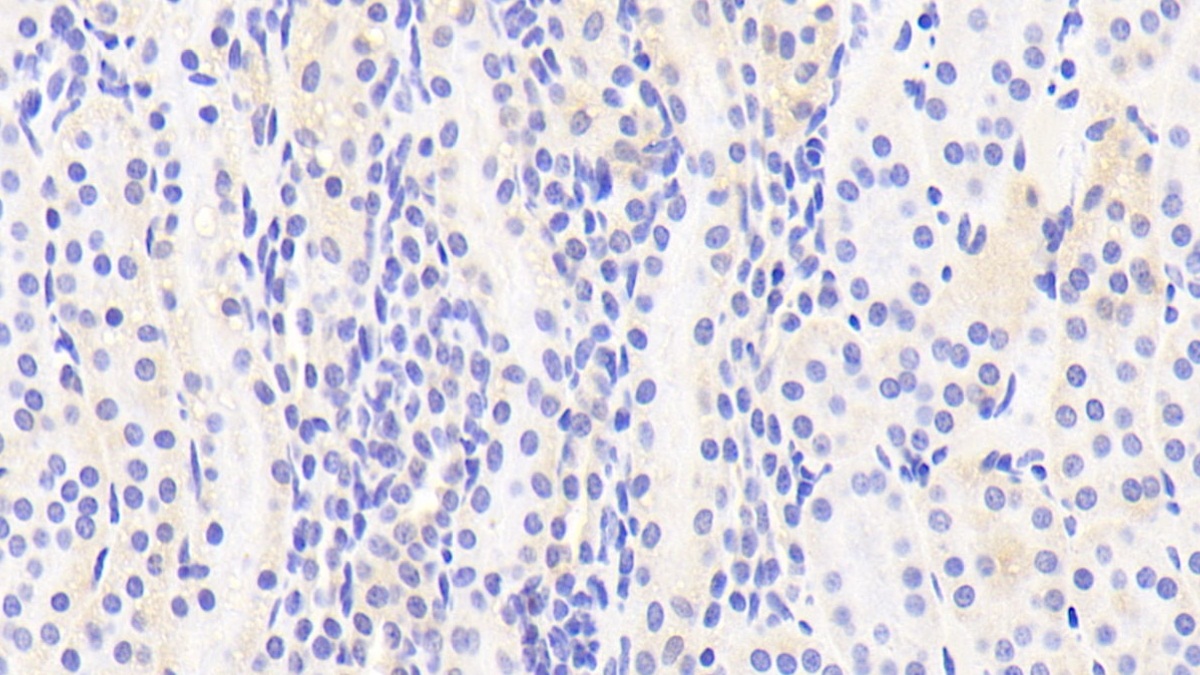 Polyclonal Antibody to Tubulin Delta (TUBd)