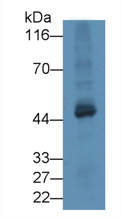 Polyclonal Antibody to Tubulin Delta (TUBd)