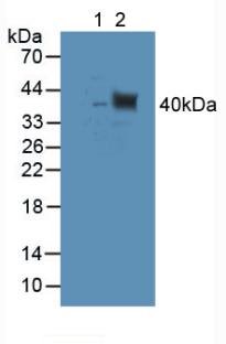 Polyclonal Antibody to Tubulin Delta (TUBd)