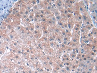 Polyclonal Antibody to Tubulin Epsilon (TUBe)