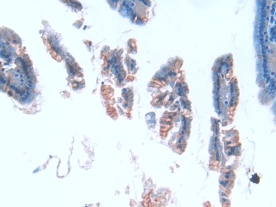 Polyclonal Antibody to Tubulin Epsilon (TUBe)