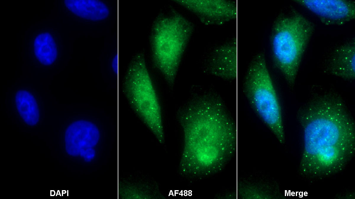 Polyclonal Antibody to Karyopherin Alpha 2 (KPNa2)