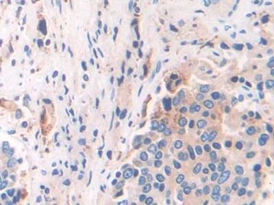 Polyclonal Antibody to Interferon Gamma Inducible Protein 30 (IFI30)