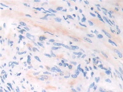 Polyclonal Antibody to Interferon Gamma Inducible Protein 30 (IFI30)