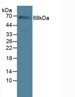 Polyclonal Antibody to Interleukin 23 Receptor (IL23R)