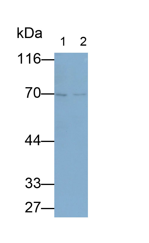 Polyclonal Antibody to Interleukin 23 Receptor (IL23R)