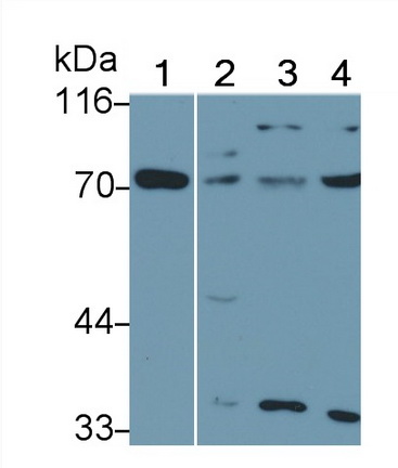 Polyclonal Antibody to Interleukin 22 Receptor (IL22R)