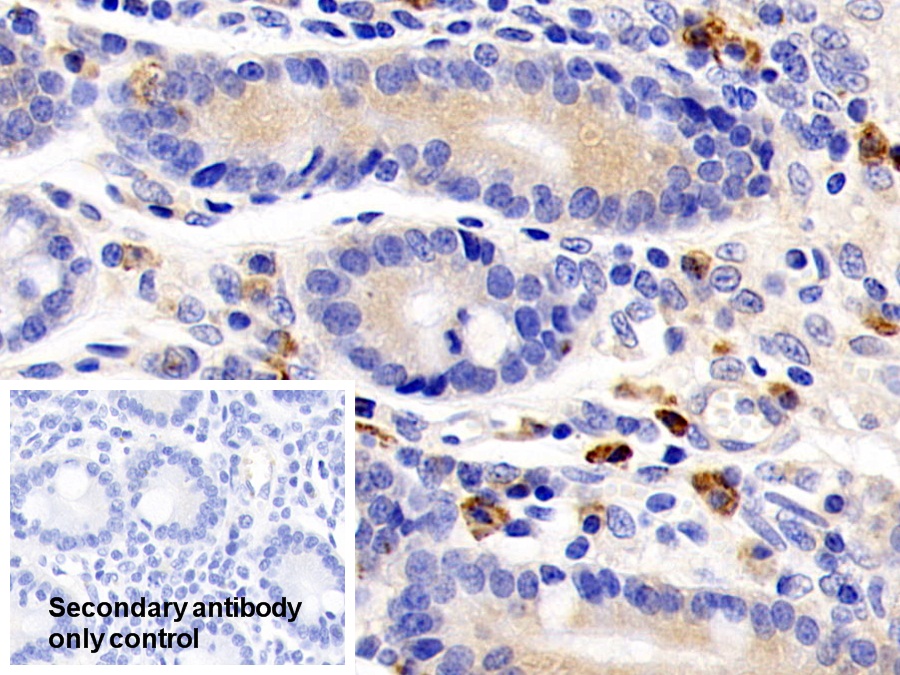 Polyclonal Antibody to Interleukin 22 Receptor (IL22R)