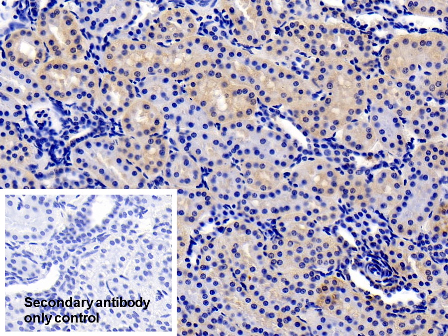 Polyclonal Antibody to Interleukin 22 Receptor (IL22R)