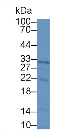 Polyclonal Antibody to Interleukin 22 Receptor Alpha 2 (IL22Ra2)