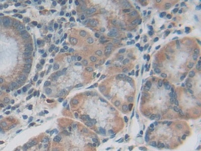 Polyclonal Antibody to Interleukin 20 Receptor Beta (IL20Rb)