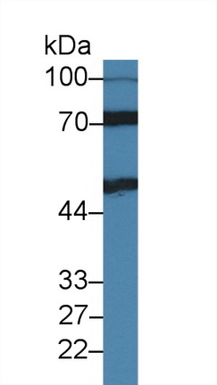 Polyclonal Antibody to Interleukin 11 Receptor Alpha (IL11Ra)