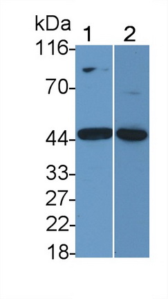 Polyclonal Antibody to Interleukin 11 Receptor Alpha (IL11Ra)