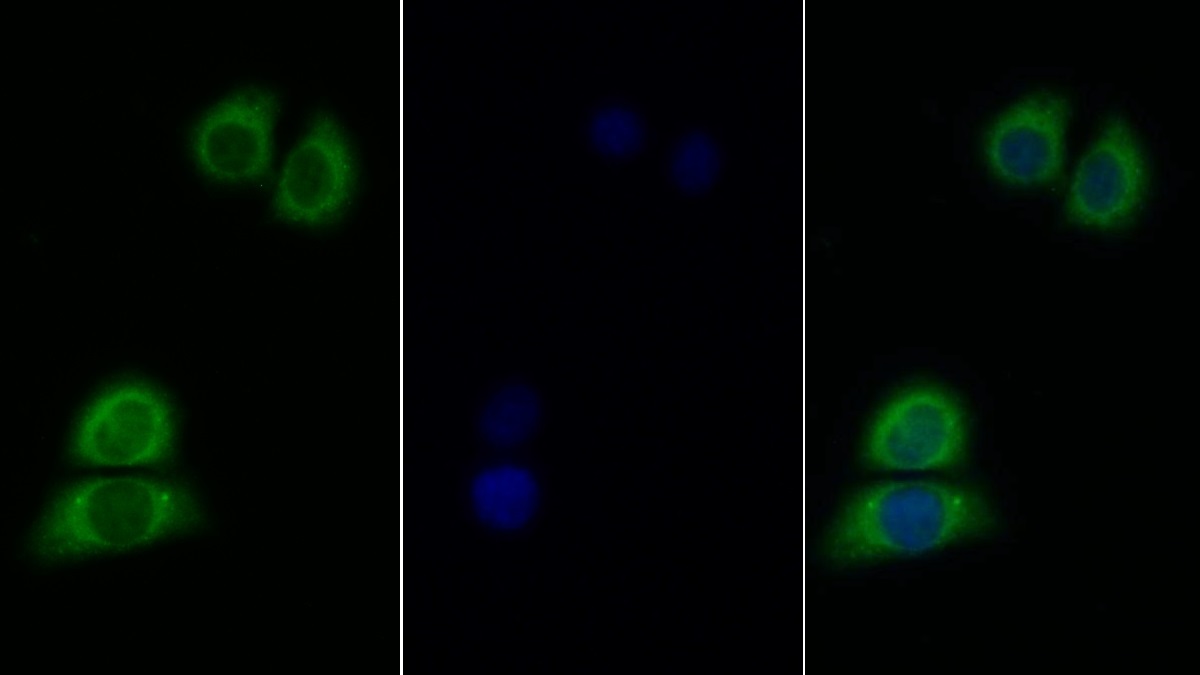 Polyclonal Antibody to Interleukin 11 Receptor Alpha (IL11Ra)