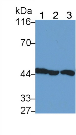 Polyclonal Antibody to Interleukin 11 Receptor Alpha (IL11Ra)