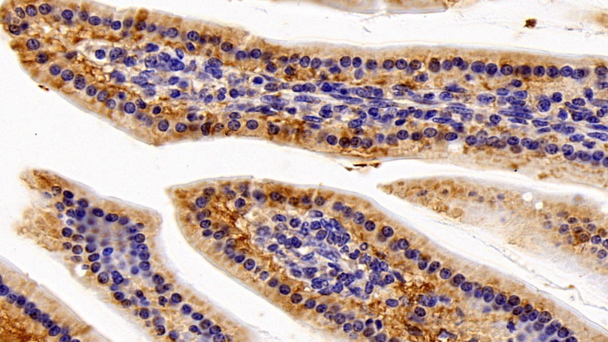 Polyclonal Antibody to Interleukin 11 Receptor Alpha (IL11Ra)