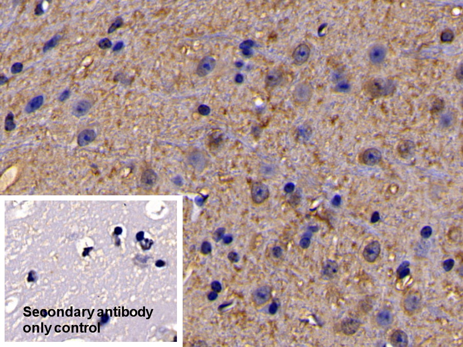 Polyclonal Antibody to Interleukin 11 Receptor Alpha (IL11Ra)