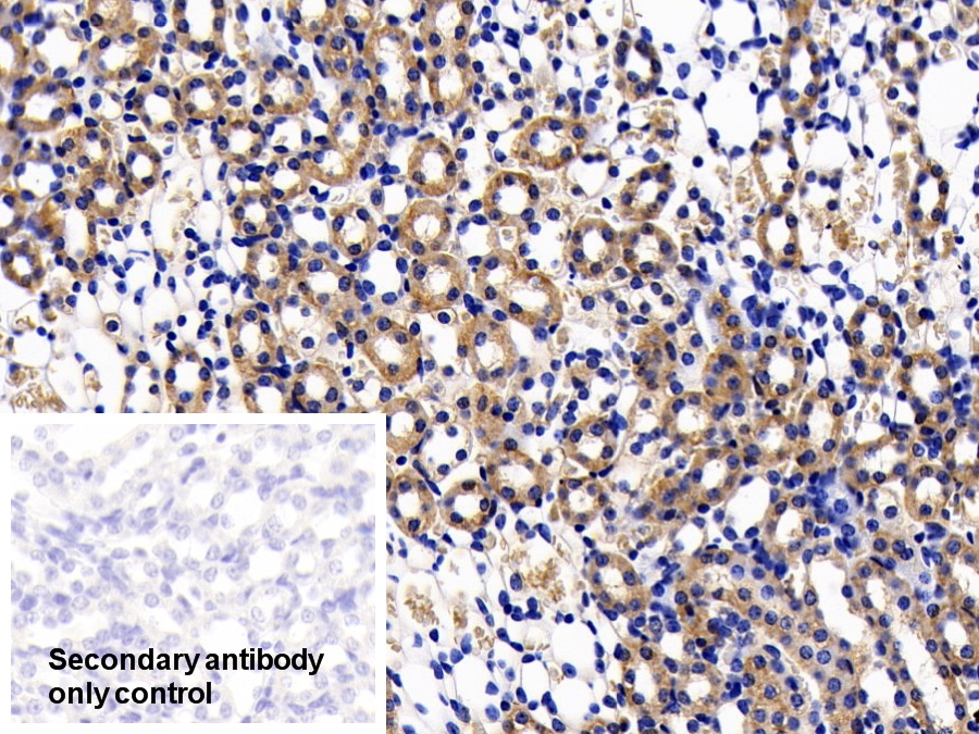 Polyclonal Antibody to Interleukin 11 Receptor Alpha (IL11Ra)