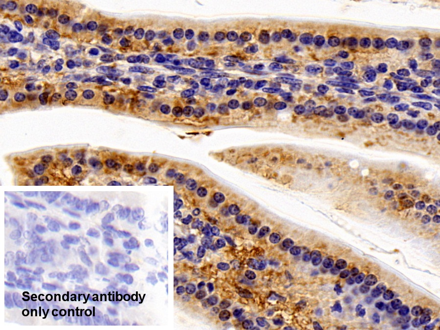 Polyclonal Antibody to Interleukin 11 Receptor Alpha (IL11Ra)