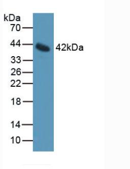 Polyclonal Antibody to Interleukin 11 Receptor Alpha (IL11Ra)