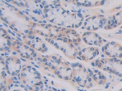 Polyclonal Antibody to Interleukin 11 Receptor Alpha (IL11Ra)