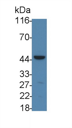 Polyclonal Antibody to Interleukin 11 Receptor Alpha (IL11Ra)