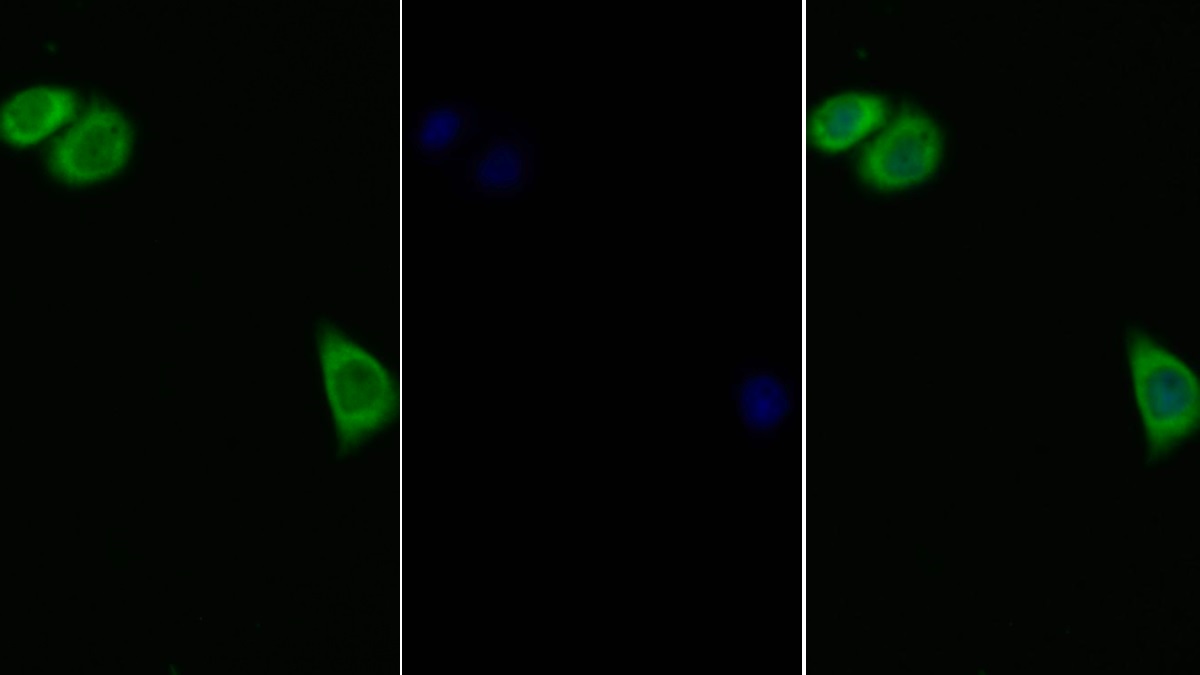 Polyclonal Antibody to Interleukin 11 Receptor Alpha (IL11Ra)