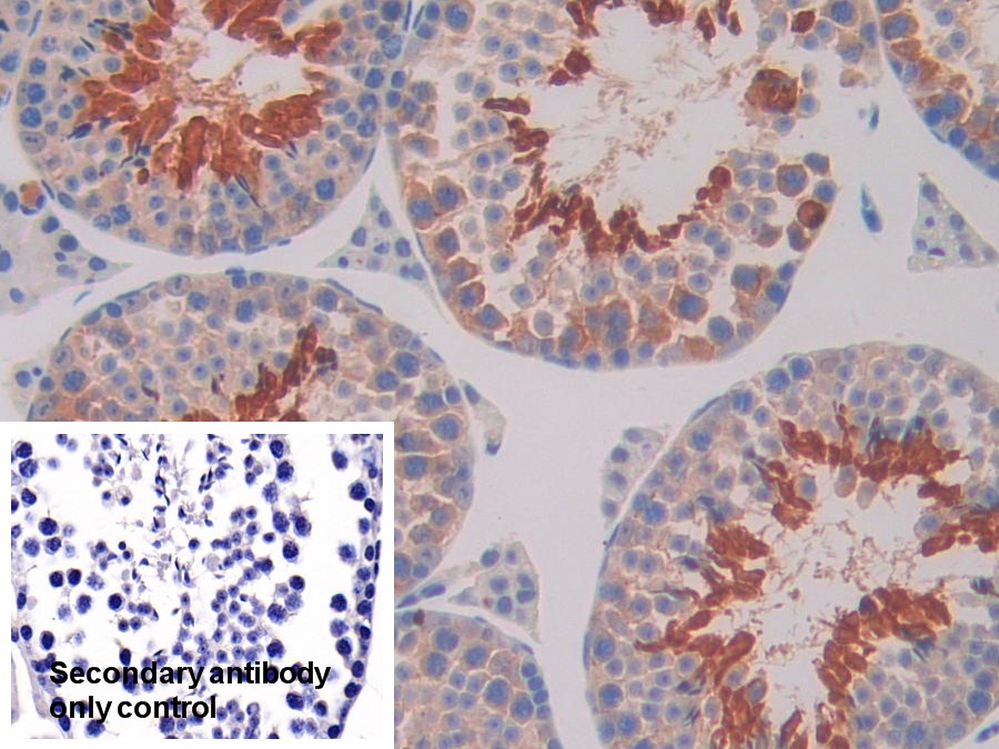 Polyclonal Antibody to Interleukin 11 Receptor Alpha (IL11Ra)