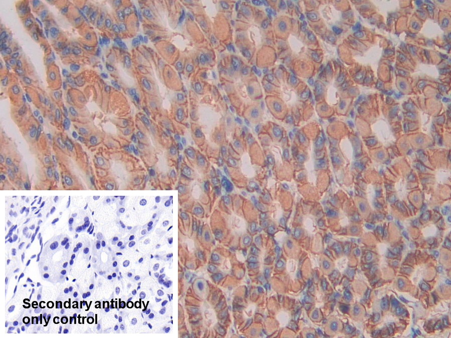 Polyclonal Antibody to Interleukin 11 Receptor Alpha (IL11Ra)