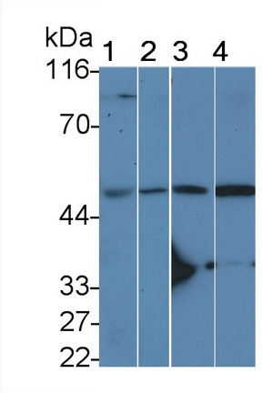 Polyclonal Antibody to Interleukin 11 Receptor Alpha (IL11Ra)