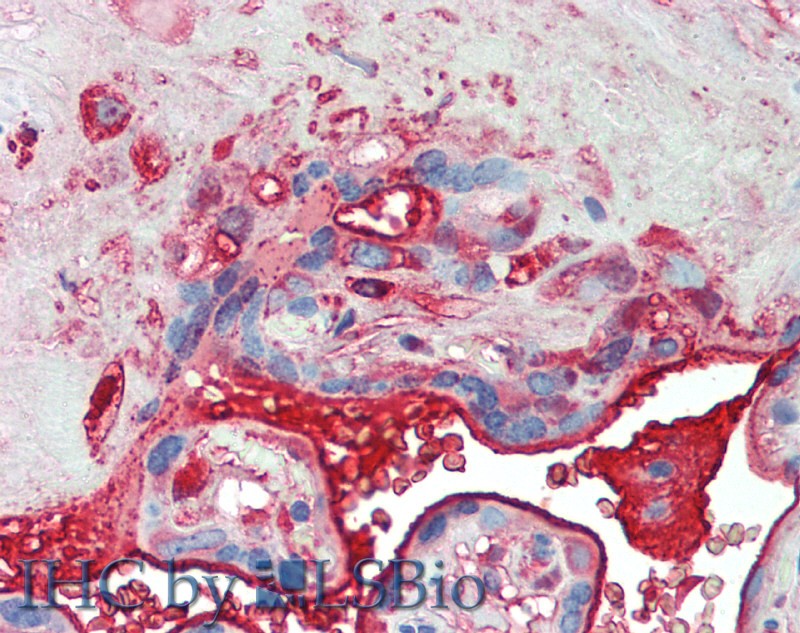 Polyclonal Antibody to Immunoglobulin A1 (IgA1)