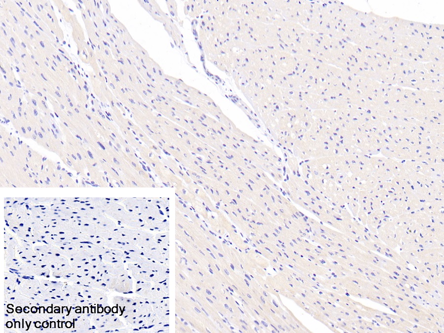 Polyclonal Antibody to Annexin A9 (ANXA9)