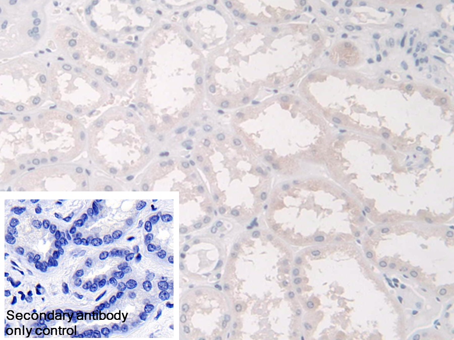 Polyclonal Antibody to Annexin A9 (ANXA9)