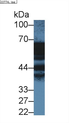 Polyclonal Antibody to Annexin A11 (ANXA11)