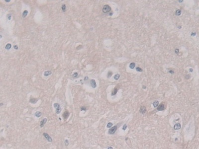 Polyclonal Antibody to Annexin A11 (ANXA11)