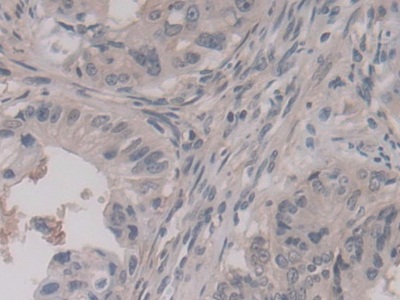 Polyclonal Antibody to Annexin A11 (ANXA11)