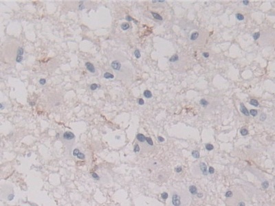 Polyclonal Antibody to Annexin A11 (ANXA11)