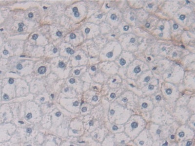 Polyclonal Antibody to Annexin A11 (ANXA11)